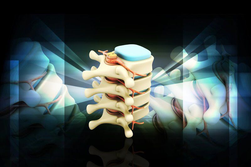 spine dorsal column stimulator