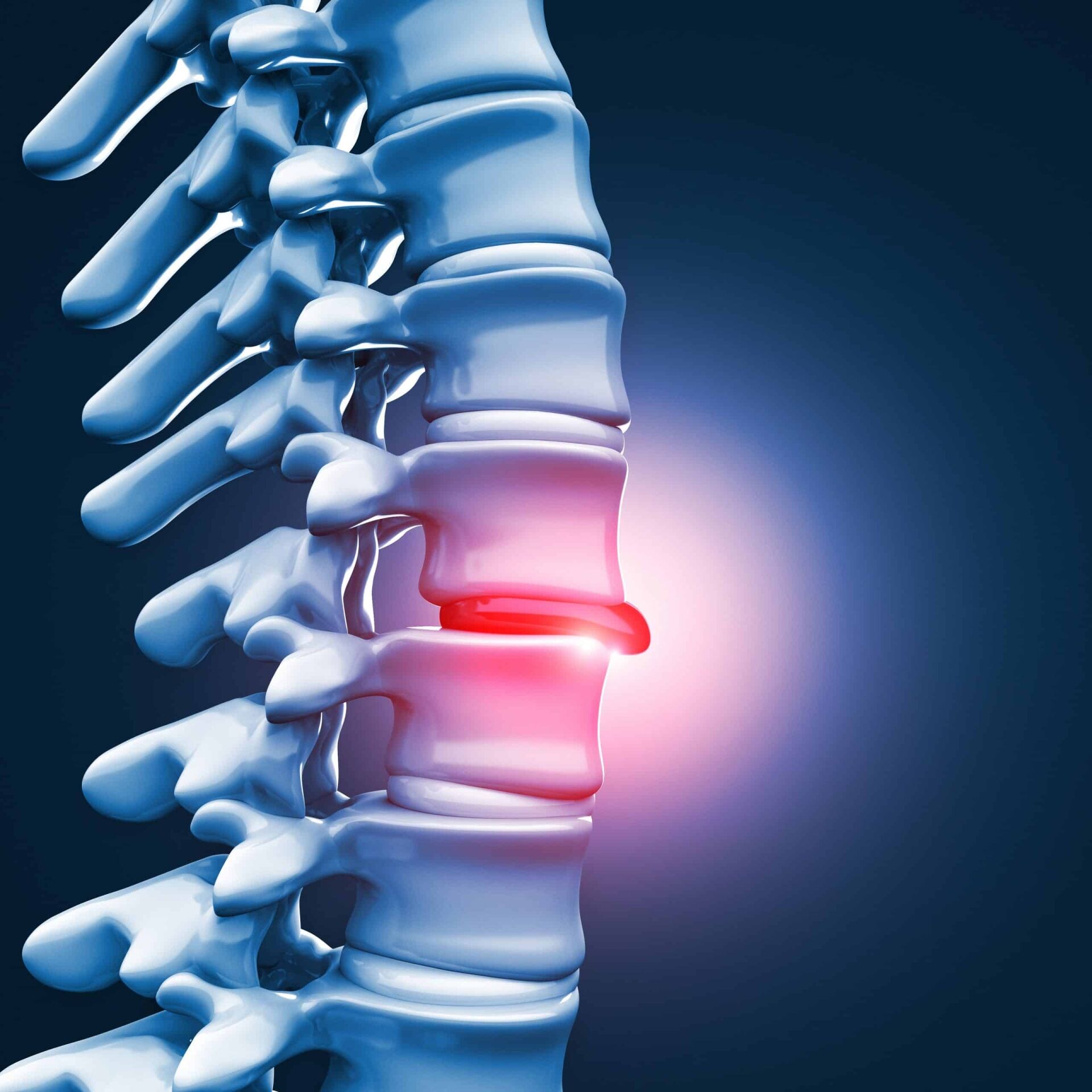 spinal vertebrae