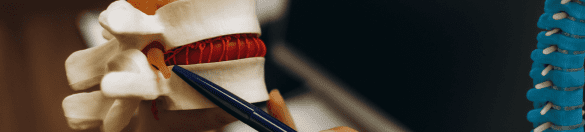 kyphoplasty recovery